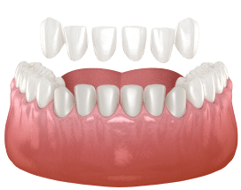 Veneers Teeth Thumb